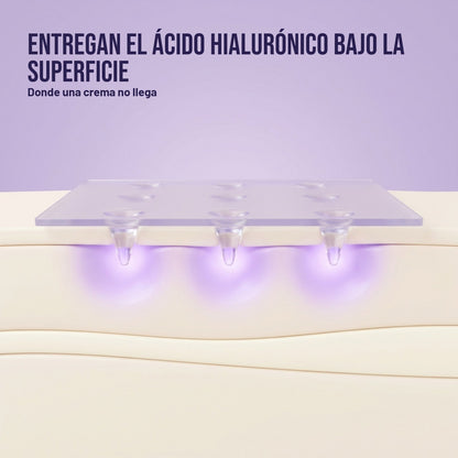 Las microagujas entregan el ácido hialurónico bajo la superficie de la piel