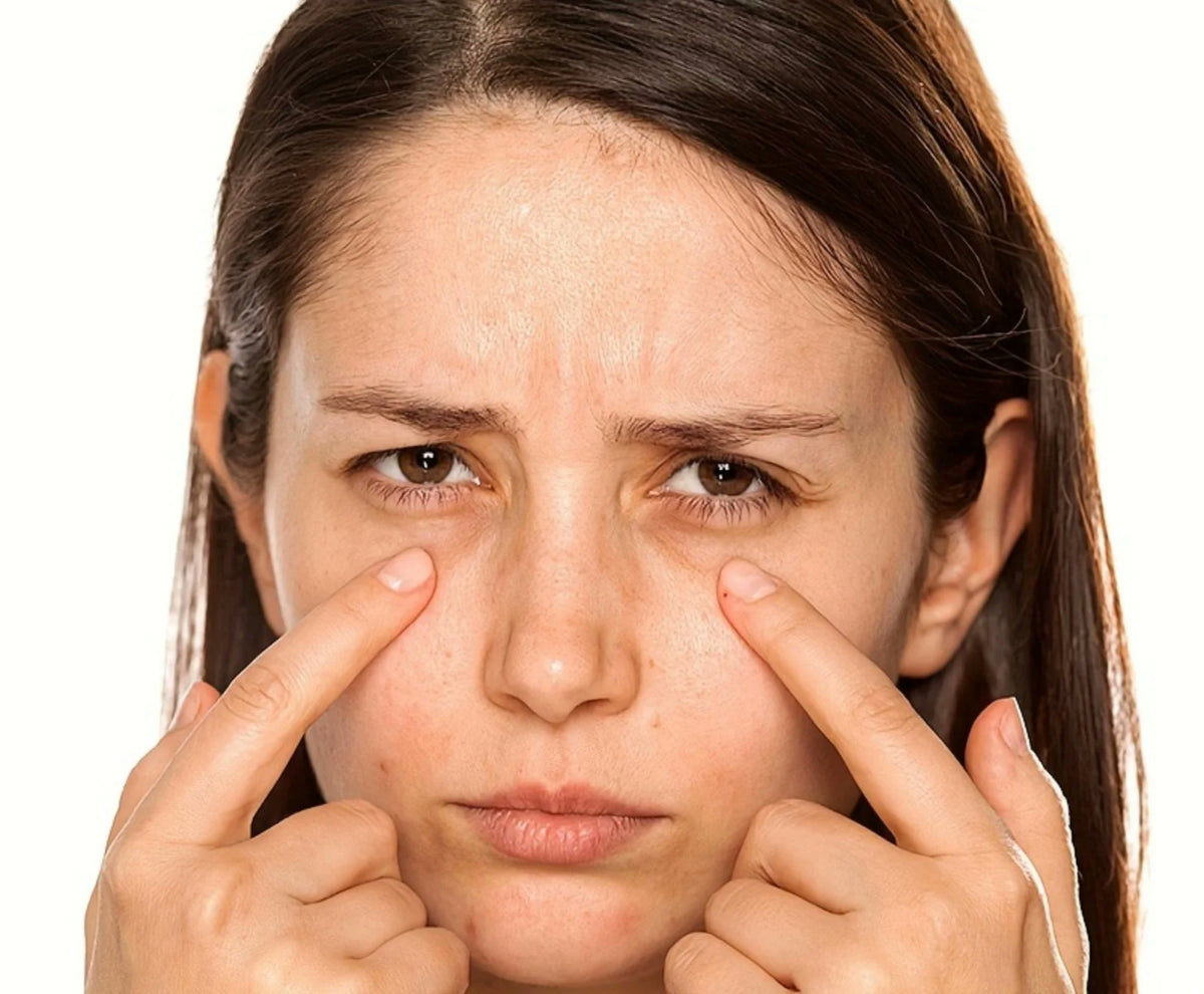 Mujer señalando sus ojeras y bolsas bajo los ojos